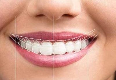 چرا کیفیت ساخت پروتزهای دندانی اهمیت زیادی دارد؟