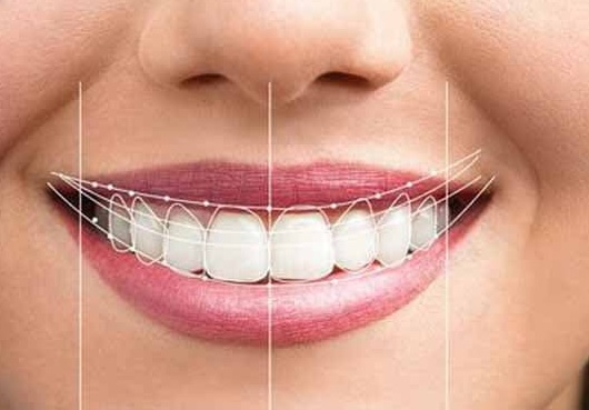 چرا کیفیت ساخت پروتزهای دندانی اهمیت زیادی دارد؟